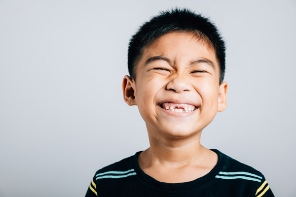 My Child Has A Broken Tooth: What To Do